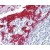 Immunohistochemistry-Paraffin: Cytokeratin 13 Antibody [NBP1-06047] -  (2.5µg/ml) staining of paraffin embedded Human Tonsil. Steamed antigen retrieval with citrate buffer pH 6, AP-staining.